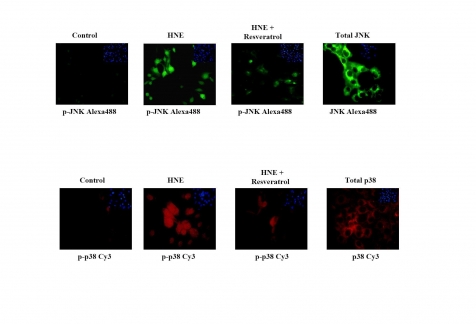 Figure 2B_modifiye